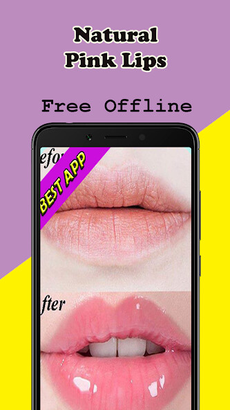 Run android online APK Natural Pink Lips Remedies from MyAndroid or emulate Natural Pink Lips Remedies using MyAndroid