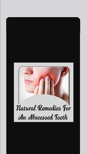 Run android online APK Natural Remedies for Abscessed Tooth from MyAndroid or emulate Natural Remedies for Abscessed Tooth using MyAndroid