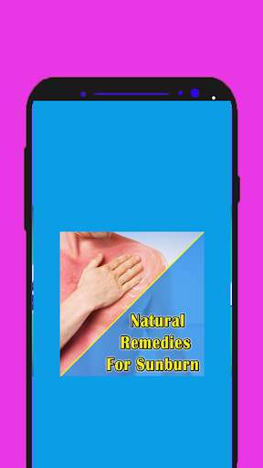 Run android online APK Natural Remedies For Sunburn from MyAndroid or emulate Natural Remedies For Sunburn using MyAndroid Run android online APK Natural Remedies For Sunburn from MyAndroid or emulate Natural Remedies For Sunburn using MyAndroid