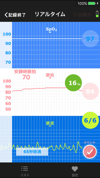 Emulate iPhone app NISSEI MP-1000NET using MyAndroid