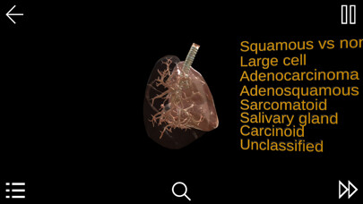 Emulate iPhone app Non-Small Cell Lung Cancer using MyAndroid Emulate iPhone app Non-Small Cell Lung Cancer using MyAndroid