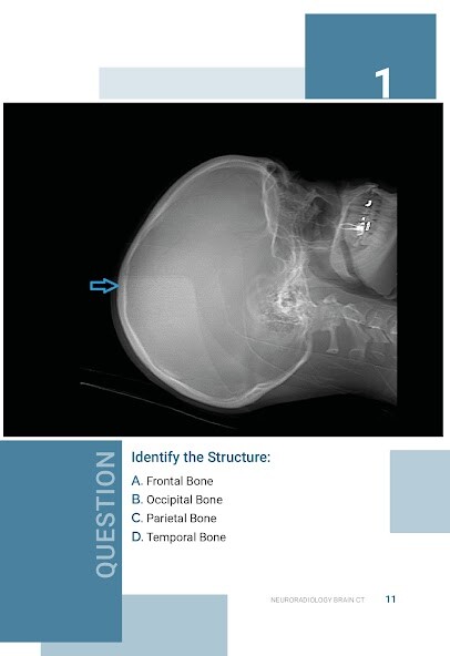 Run android online APK Normal Radiology: CT Brain from MyAndroid or emulate Normal Radiology: CT Brain using MyAndroid Run android online APK Normal Radiology: CT Brain from MyAndroid or emulate Normal Radiology: CT Brain using MyAndroid