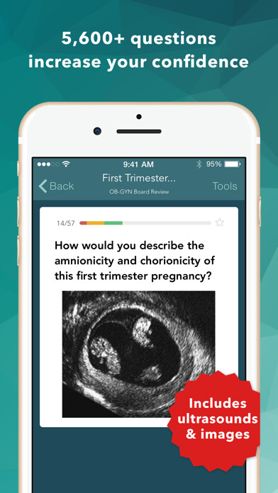Emulate iPhone app Ob Gyn Board Review Flashcards using MyAndroid Emulate iPhone app Ob Gyn Board Review Flashcards using MyAndroid