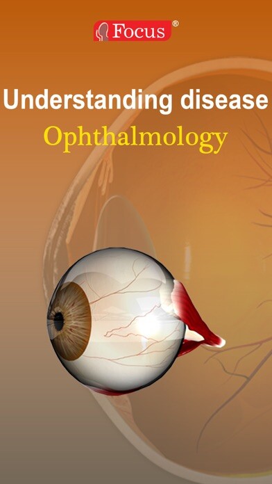 Emulate iPhone app Ophthalmology - Understanding Disease using MyAndroid Emulate iPhone app Ophthalmology - Understanding Disease using MyAndroid