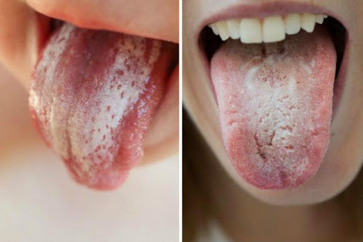 Run android online APK Oral Thrush Remedies from MyAndroid or emulate Oral Thrush Remedies using MyAndroid Run android online APK Oral Thrush Remedies from MyAndroid or emulate Oral Thrush Remedies using MyAndroid