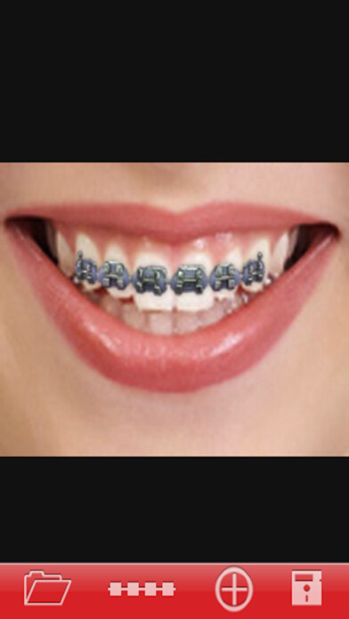 Emulate iPhone app Orthodontic using MyAndroid Emulate iPhone app Orthodontic using MyAndroid
