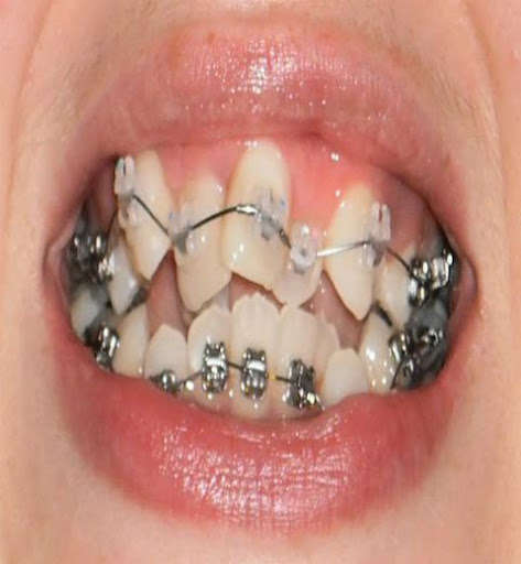 Run android online APK orthodontist guide from MyAndroid or emulate orthodontist guide using MyAndroid Run android online APK orthodontist guide from MyAndroid or emulate orthodontist guide using MyAndroid