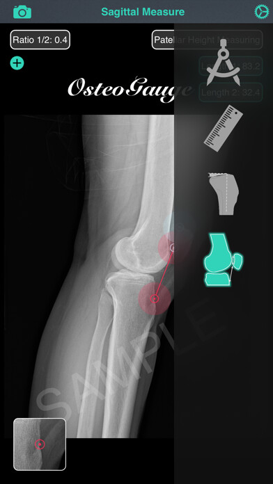 Emulate iPhone app OsteoGauge - lower limb using MyAndroid Emulate iPhone app OsteoGauge - lower limb using MyAndroid