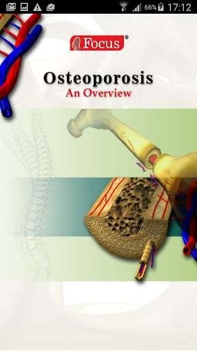 Emulate Android APK Osteoporosis Emulate Android APK Osteoporosis