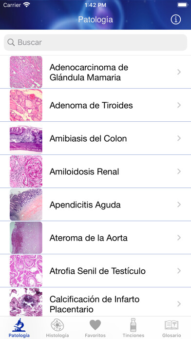 Emulate iPhone app Patología Clínica using MyAndroid Emulate iPhone app Patología Clínica using MyAndroid