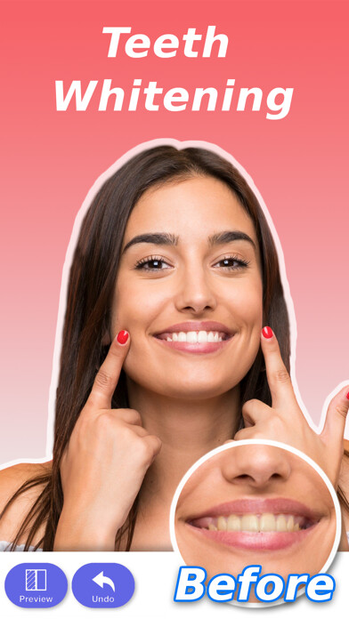 Emulate iPhone app Perfect Smile: Teeth Whitening using MyAndroid