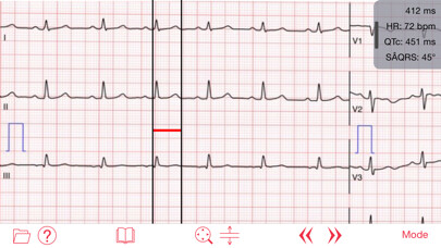 Emulate iPhone app Photo EKG using MyAndroid Emulate iPhone app Photo EKG using MyAndroid