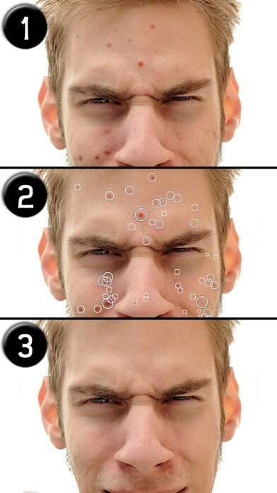 Emulate iPhone app Pimple Eraser LITE using MyAndroid Emulate iPhone app Pimple Eraser LITE using MyAndroid