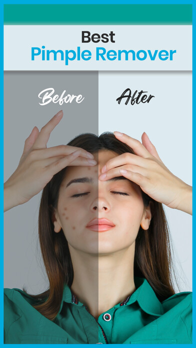 Emulate iPhone app Pimple Remover + using MyAndroid