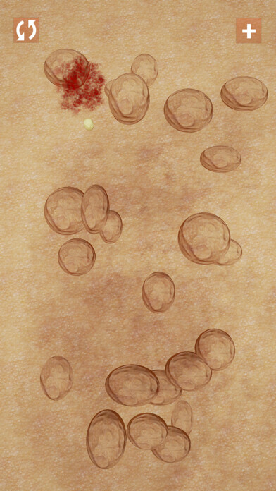 Emulate iPhone app Pimples & Zits using MyAndroid Emulate iPhone app Pimples & Zits using MyAndroid