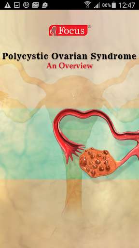 Emulate Android APK Polycystic ovarian syndrome
