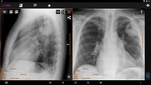 Run android online APK PORT-RAY: DICOM Viewer (5.4) from MyAndroid or emulate PORT-RAY: DICOM Viewer (5.4) using MyAndroid Run android online APK PORT-RAY: DICOM Viewer (5.4) from MyAndroid or emulate PORT-RAY: DICOM Viewer (5.4) using MyAndroid