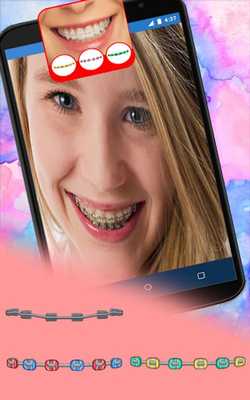 Emulate Android APK Pro Braces Teeth Booth