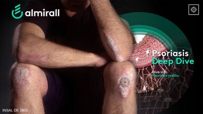 Emulate iPhone app Psoriasis Deep Dive using MyAndroid Emulate iPhone app Psoriasis Deep Dive using MyAndroid