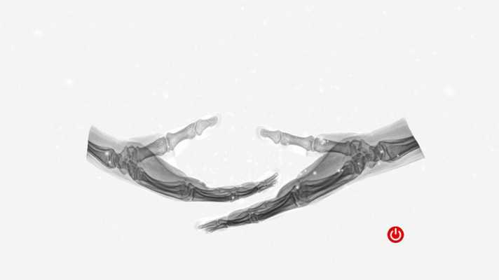 Emulate Android APK Radiographic Anatomy X-Ray Emulate Android APK Radiographic Anatomy X-Ray