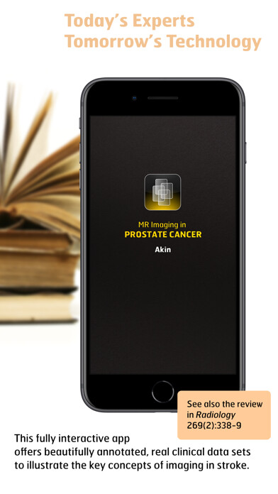 Emulate iPhone app Radiology - Imaging in Stroke using MyAndroid Emulate iPhone app Radiology - Imaging in Stroke using MyAndroid