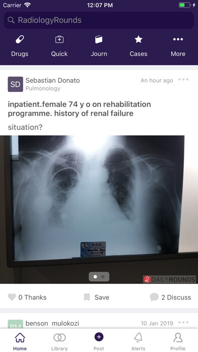 Emulate iPhone app Radiology Rounds -Radiologists using MyAndroid Emulate iPhone app Radiology Rounds -Radiologists using MyAndroid