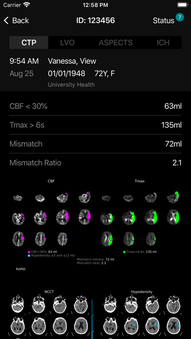 Emulate iPhone app RAPID.AI using MyAndroid Emulate iPhone app RAPID.AI using MyAndroid