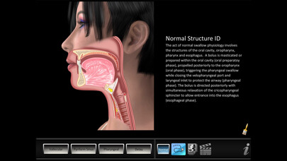 Emulate iPhone app Residue Disorders using MyAndroid Emulate iPhone app Residue Disorders using MyAndroid