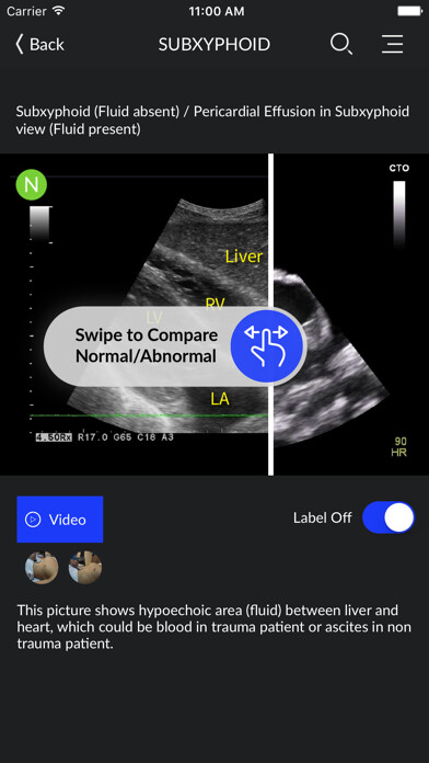 Emulate iPhone app RESUS Ultrasound using MyAndroid Emulate iPhone app RESUS Ultrasound using MyAndroid