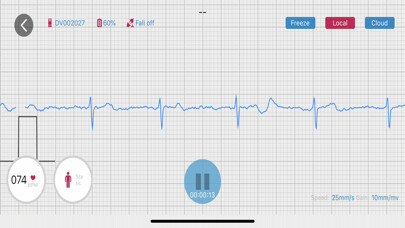 Emulate iPhone app RhythmWatch using MyAndroid