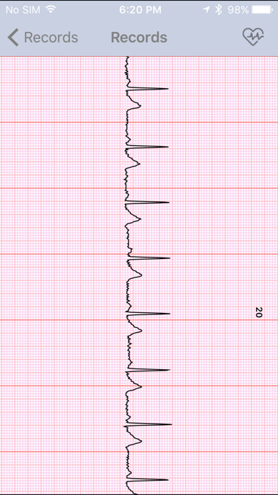 Emulate iPhone app Sanitas ECG Manager using MyAndroid