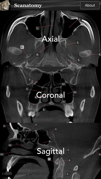 Emulate iPhone app Scanatomy using MyAndroid Emulate iPhone app Scanatomy using MyAndroid