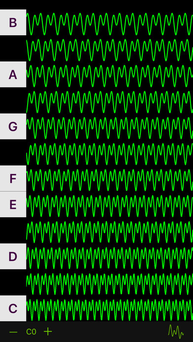 Emulate iPhone app ScopeTune using MyAndroid
