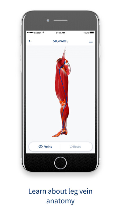 Emulate iPhone app SIGVARIS GROUP Vein App using MyAndroid Emulate iPhone app SIGVARIS GROUP Vein App using MyAndroid