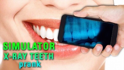 Emulate iPhone app Simulator X-ray Teeth Prank using MyAndroid