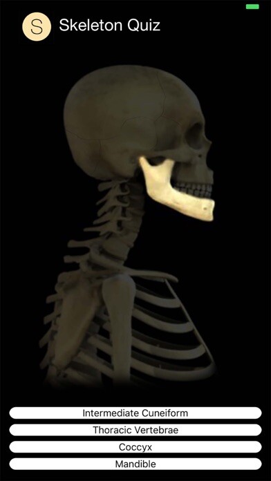 Emulate iPhone app Skeleton Quiz using MyAndroid Emulate iPhone app Skeleton Quiz using MyAndroid