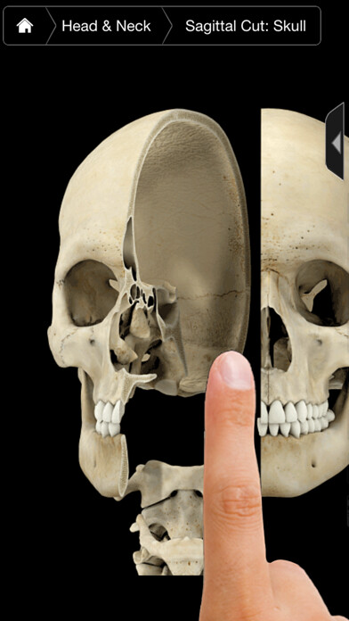 Emulate iPhone app Skeleton System Pro III-iPhone using MyAndroid Emulate iPhone app Skeleton System Pro III-iPhone using MyAndroid