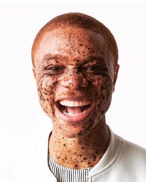Run android online APK Skin Cancer Guide from MyAndroid or emulate Skin Cancer Guide using MyAndroid Run android online APK Skin Cancer Guide from MyAndroid or emulate Skin Cancer Guide using MyAndroid