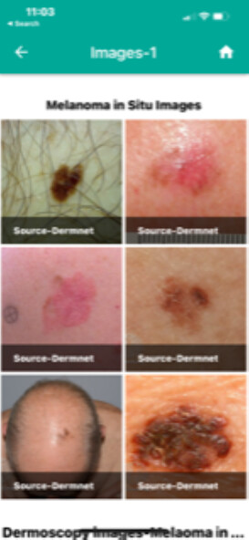 Run android online APK Skin cancer Scoring App from MyAndroid or emulate Skin cancer Scoring App using MyAndroid Run android online APK Skin cancer Scoring App from MyAndroid or emulate Skin cancer Scoring App using MyAndroid