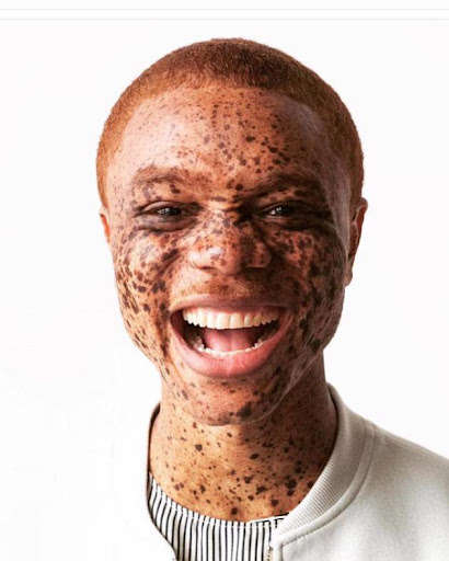 Run android online APK Skin Cancer from MyAndroid or emulate Skin Cancer using MyAndroid