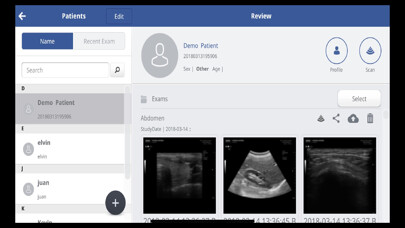 Emulate iPhone app SONON X Ultrasound App US / KR using MyAndroid Emulate iPhone app SONON X Ultrasound App US / KR using MyAndroid