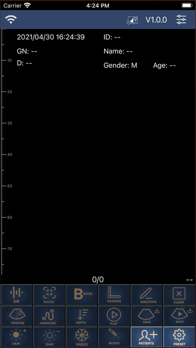 Emulate iPhone app Sonoque using MyAndroid