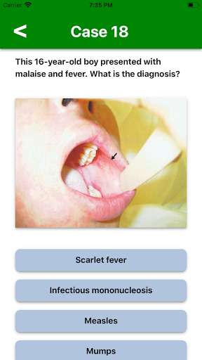 Run android online APK Spotters 1 Lite from MyAndroid or emulate Spotters 1 Lite using MyAndroid