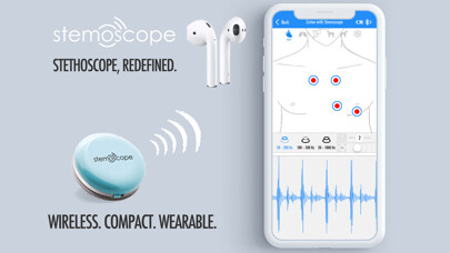 Emulate iPhone app Stemoscope using MyAndroid Emulate iPhone app Stemoscope using MyAndroid