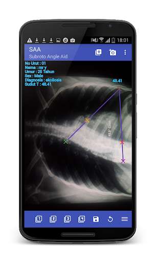 Run android online APK Subroto Angle Aid from MyAndroid or emulate Subroto Angle Aid using MyAndroid Run android online APK Subroto Angle Aid from MyAndroid or emulate Subroto Angle Aid using MyAndroid