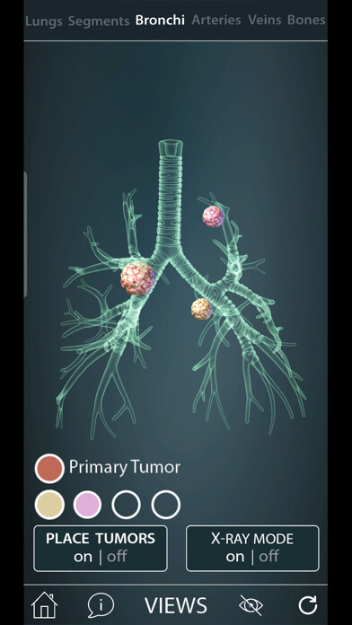 Emulate iPhone app Surgical Anatomy of the Lung using MyAndroid Emulate iPhone app Surgical Anatomy of the Lung using MyAndroid