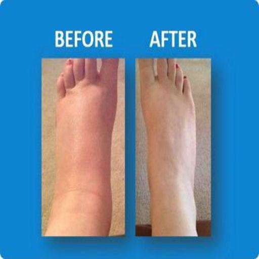 Run android online APK Swollen Feet (Guide) from MyAndroid or emulate Swollen Feet (Guide) using MyAndroid Run android online APK Swollen Feet (Guide) from MyAndroid or emulate Swollen Feet (Guide) using MyAndroid