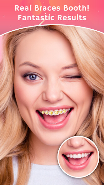 Run android online APK Teeth Braces Photo editor from MyAndroid or emulate Teeth Braces Photo editor using MyAndroid Run android online APK Teeth Braces Photo editor from MyAndroid or emulate Teeth Braces Photo editor using MyAndroid