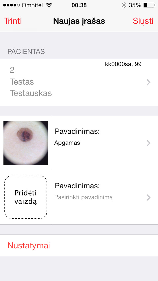 Emulate iPhone app Telemedicine Camera using MyAndroid Emulate iPhone app Telemedicine Camera using MyAndroid