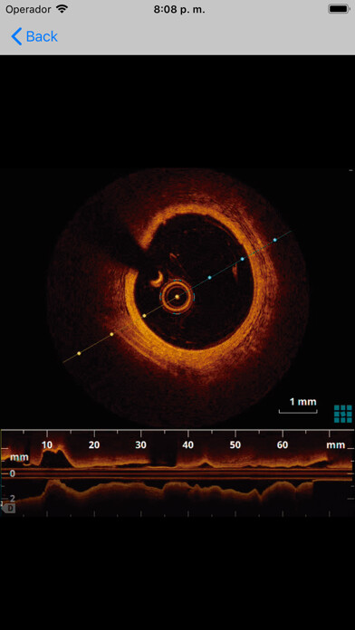 Emulate iPhone app Texto de Cardiología SIAC RA using MyAndroid Emulate iPhone app Texto de Cardiología SIAC RA using MyAndroid